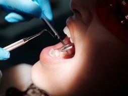 zubar, zubi, pregled