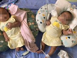 James Finley, blizanci