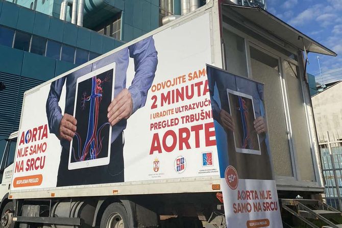 Trbušna aorta, aorta, aneurizma Trbušna aorta, aorta, aneurizma