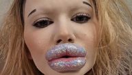 Žena sa najvećim usnama: Potrošila više od 20.000 evra na korekcije, ali pravoj ljubavi ni traga