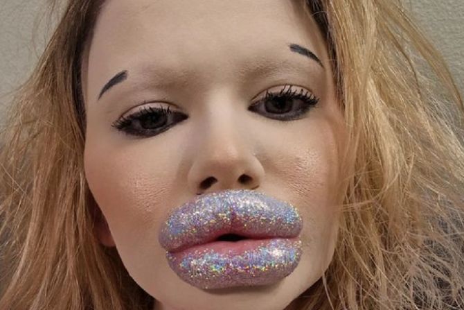 Andrea Ivanova, najveće usne na svetu Andrea Ivanova, najveće usne na svetu