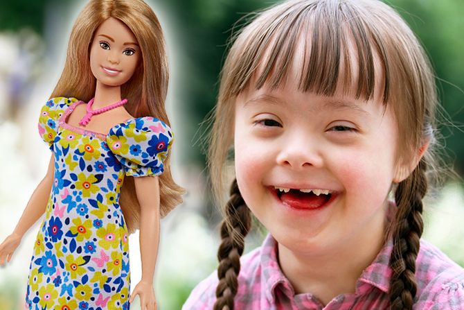 Barbi lutka Daunov sindrom Barbie Doll Down Syndrome