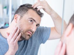 muška ćelavost, gubitak kose, androgena alopecija