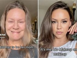 Traka za podmlađivanje