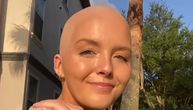 Vaspitačica napravila džinovsku tetovažu na glavi nakon što je izgubila svu kosu usled četvrte faze raka