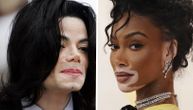 Svetski dan vitiliga: Sve o stanju zbog kojeg je Majkl Džekson promenio boju kože, a Vini Harlou stekla slavu