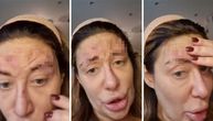 Neka neko pomogne ovoj ženi: Osvanuo snimak Ane Nikolić sa jezivim ranama na licu