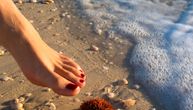 Kako da sami izvadite iglice morskog ježa: Prva pomoć u ključnom trenutku