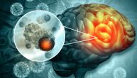Neurohirurzi veruju da veštačka inteligencija može da pomogne u lečenju tumora na mozgu