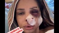 Nikad objavljene slike Nataše Šavije iz bolnice, nakon što je pretučena: Iščupan grumen kose, jeziv prizor