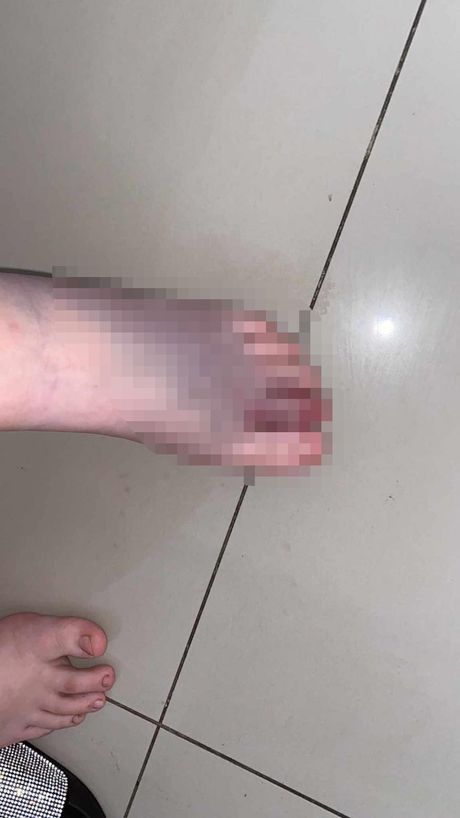 Poskok Pahljevići Zvornik