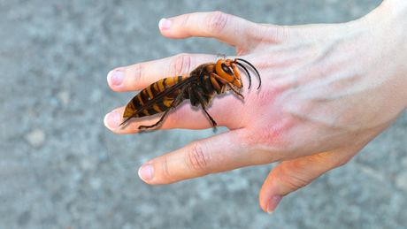 Žena ujed insekta stršljen Žena ujed insekta stršljen