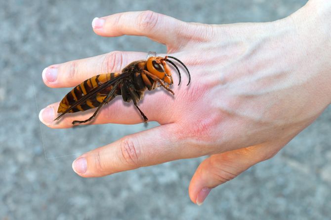 Žena ujed insekta stršljen