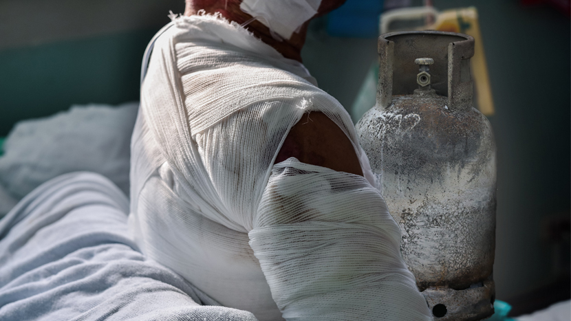 UŽAS U BATAJNICI: Plin počeo da curi, majka i sin pokušali da ugase plamen pa zadobili TEŠKE OPEKOTINE