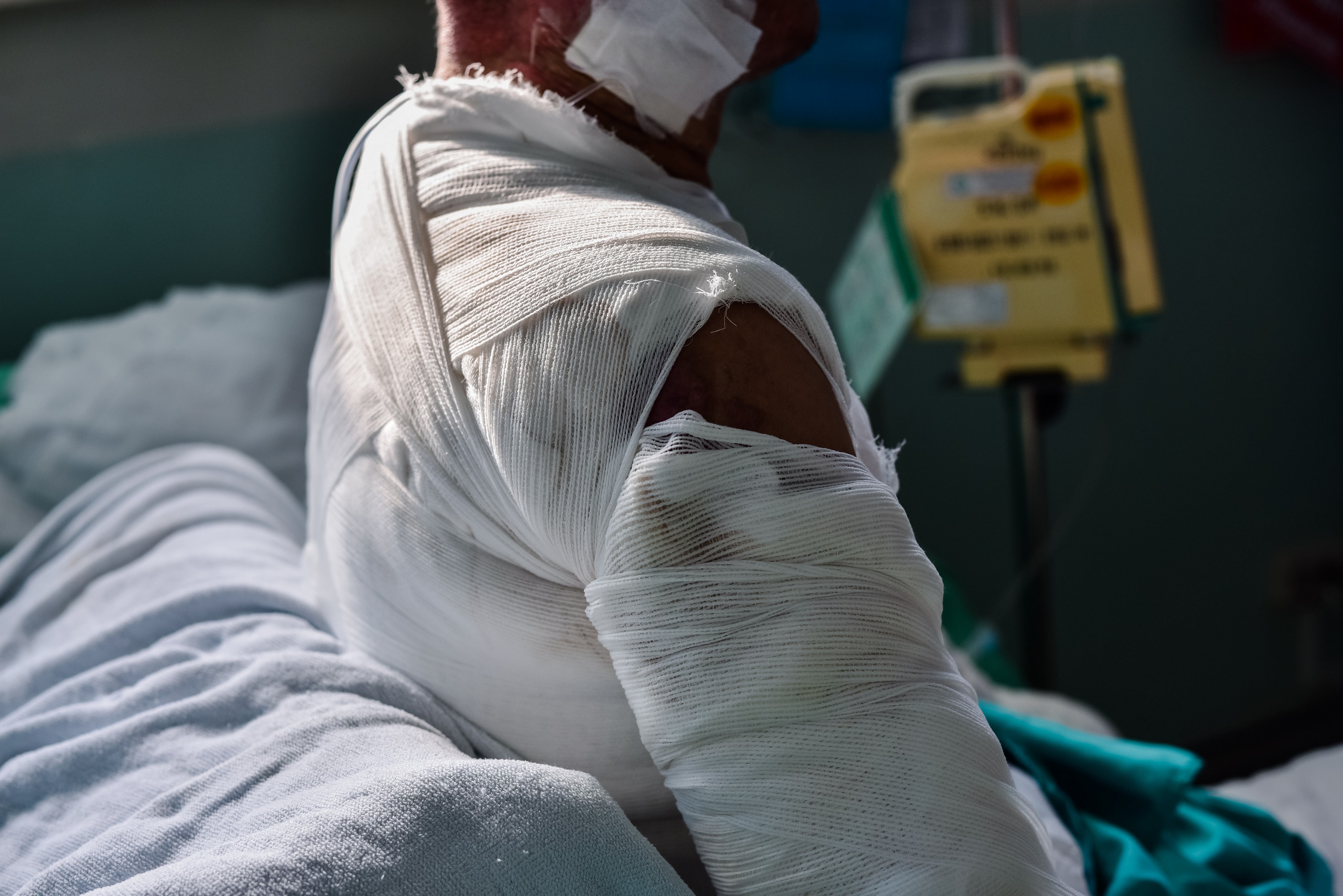 "Koža sa grudi mu je otpadala zajedno s majicom": Običan kuhinjski uređaj umalo koštao Kristininog sina života