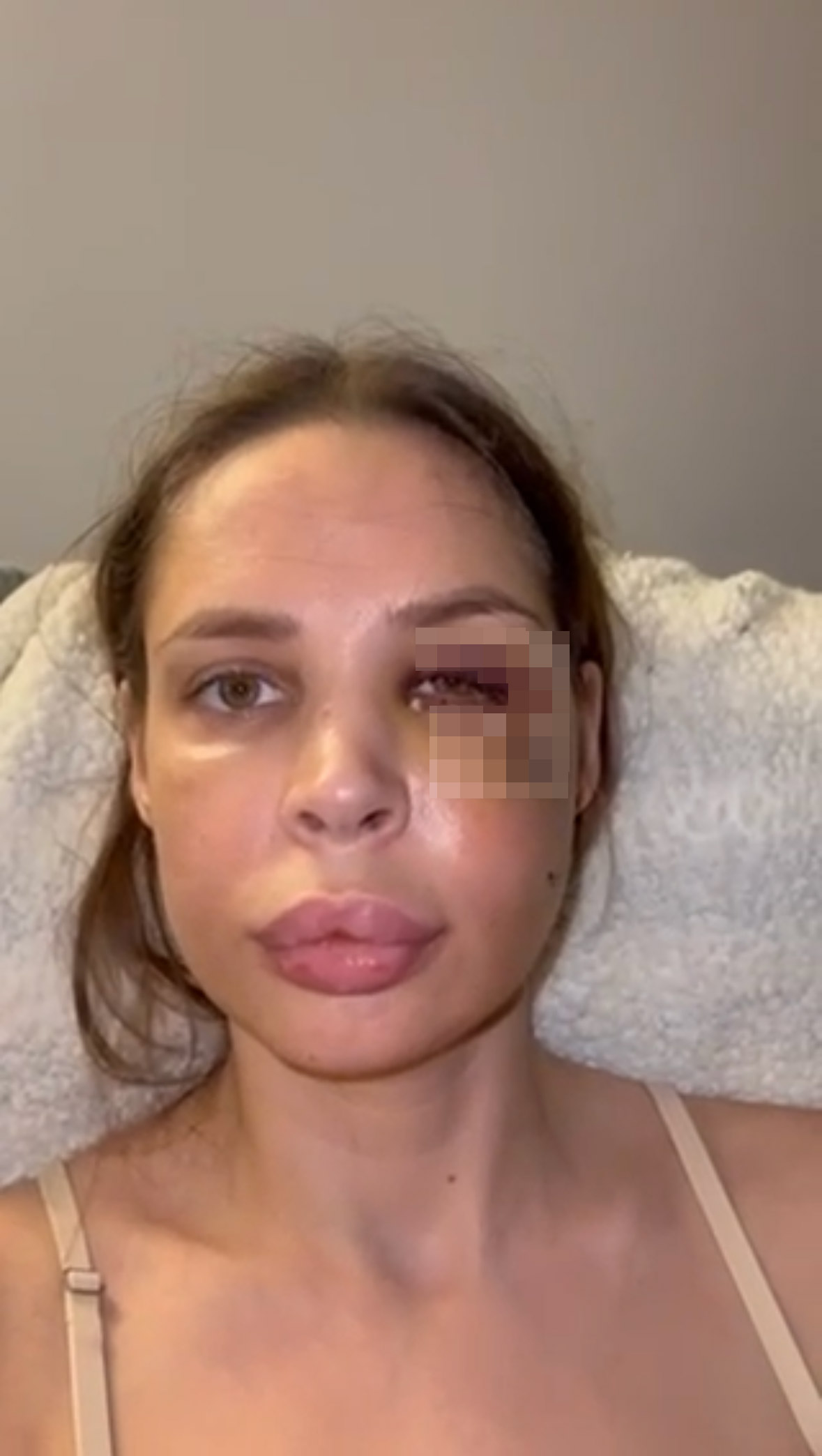 "Deformisana sam" Šavija je ovako govorila o nasilju koje je doživela od Stefana Karića: Izrečena mu presuda