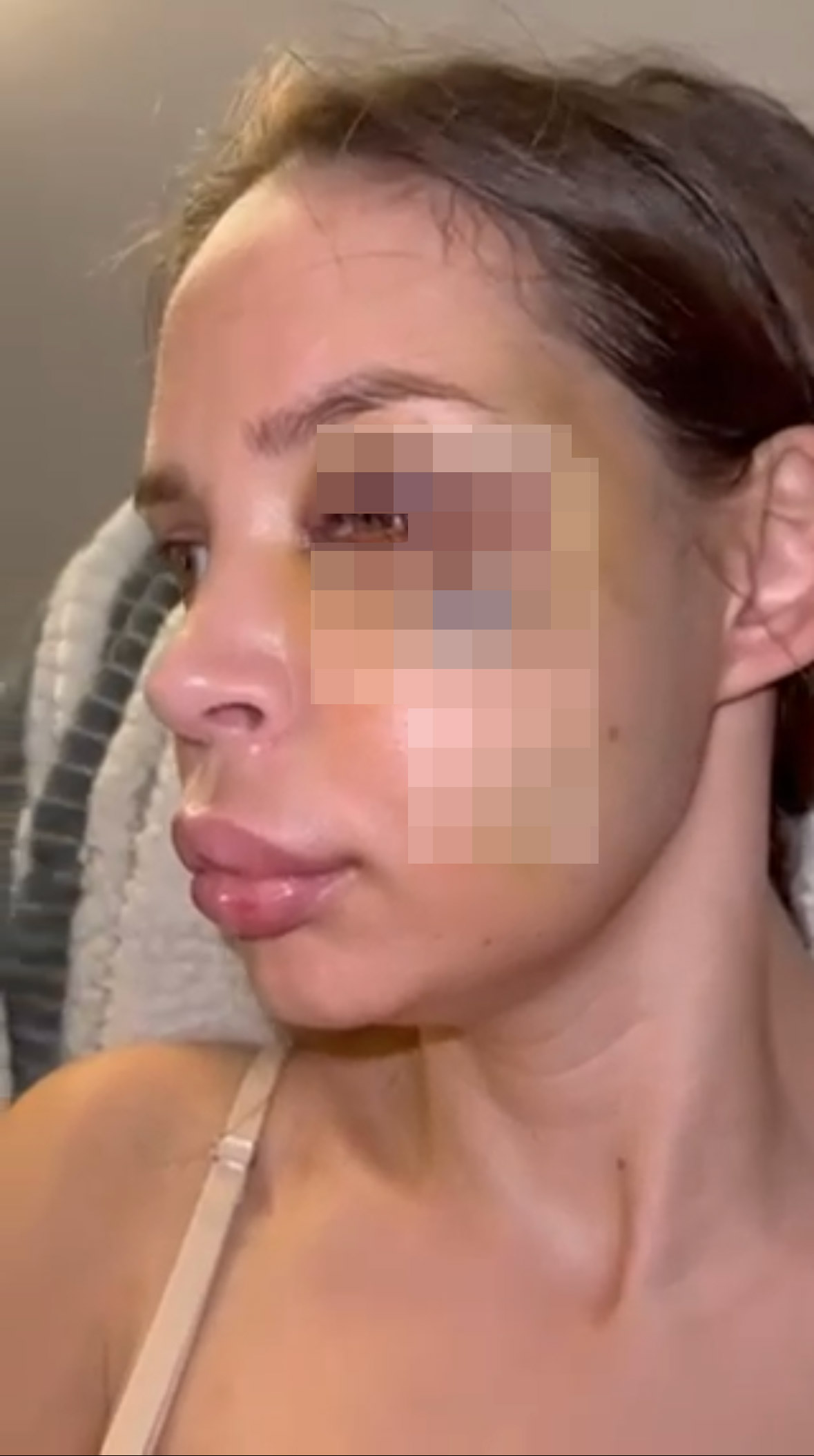 "Deformisana sam" Šavija je ovako govorila o nasilju koje je doživela od Stefana Karića: Izrečena mu presuda