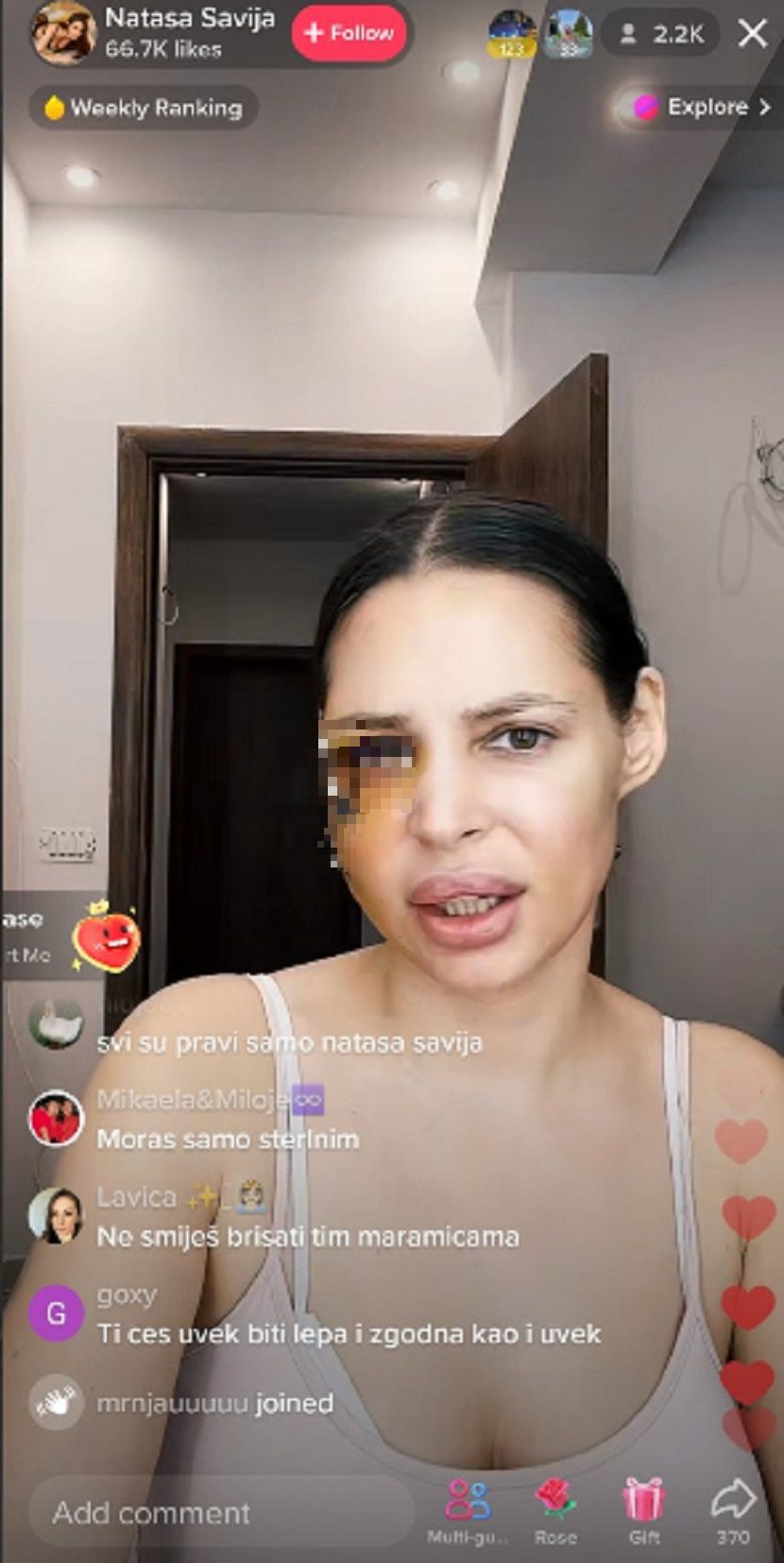 "Deformisana sam" Šavija je ovako govorila o nasilju koje je doživela od Stefana Karića: Izrečena mu presuda