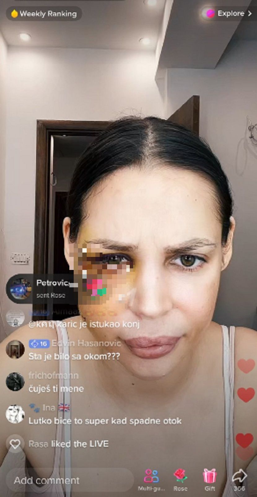 "Deformisana sam" Šavija je ovako govorila o nasilju koje je doživela od Stefana Karića: Izrečena mu presuda