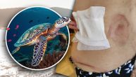 Sve pomodrelo, curila i krv: Pogledajte kako izgledaju rane nakon napada kornjače u Jadranskom moru