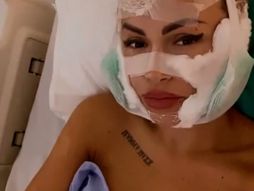 Ermina Pašović, plastična operacija, platsična hirurgija, estetska hirurgija