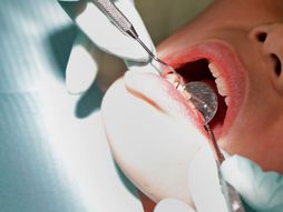 zubar stomatolog popravka zuba, popravljanje zuba