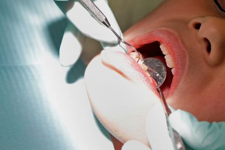 zubar stomatolog popravka zuba, popravljanje zuba
