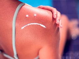 sunčanje, letovanje, krema za sunčanje, losion za posle sunčanja