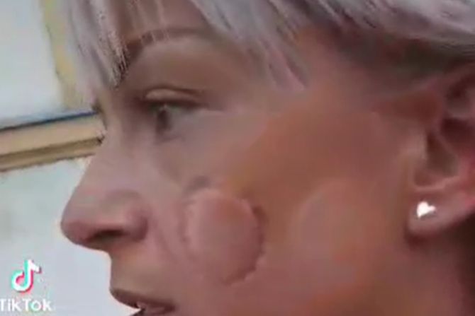 Ženu napao muškarac, Sremska Mitrovica Ženu napao muškarac, Sremska Mitrovica