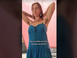 Lydi Winter maljavost dlake