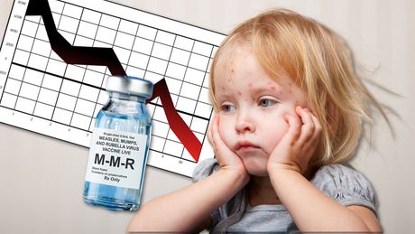Male boginje i MMR vakcina, fijasko sa vakcinacijom
