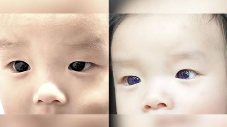 Beba, promena boje očiju