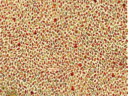 mozgalica test Dudolf