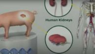 Naučnici razvijaju ljudske bubrege unutar svinjskih embriona