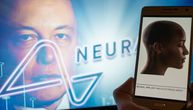 Sve što treba da znate o Maskovom Neuralinku i moždanom čipu: "Omogućava korišćenje uređaja mislima"