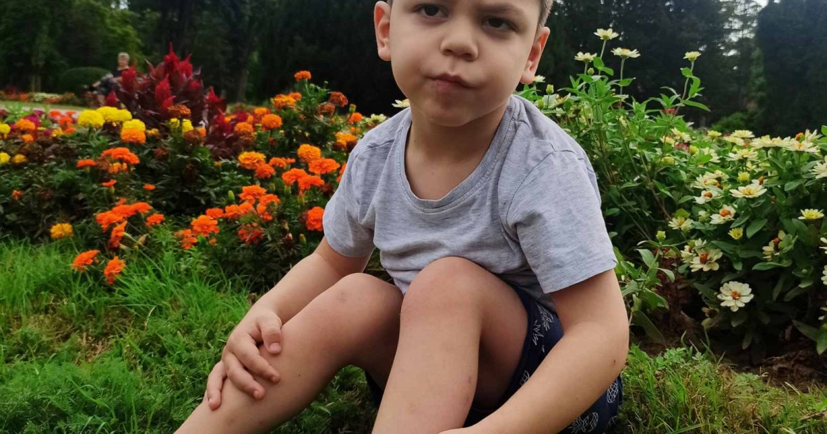 Little Vojin Must Exercise Daily to Stand on His Feet: Humanity Can Now Change His Life