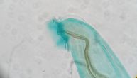 Parazitski valjkasti crv širi se po Americi: Iz pacova može da pređe na ljude