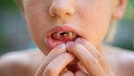 Popijte lek da vam izraste novi zub: Japanski tim razvio revolucionarnu terapiju
