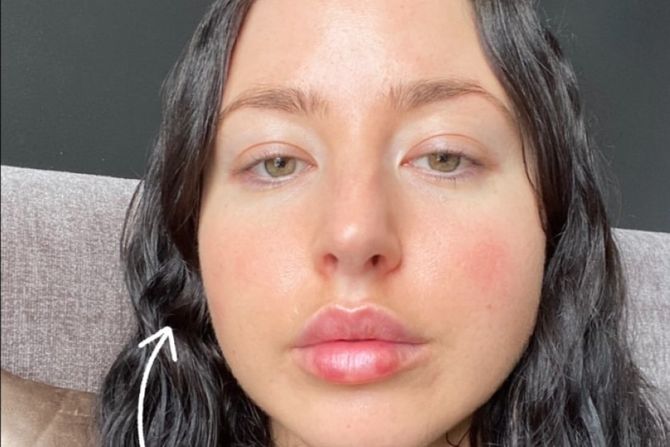 Laura Denison Laura Denison