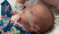 Da mama nije verovala svom osećaju, ova beba bi stradala od obične prehlade: Organi su joj otkazivali rapidno