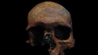 Trpeo je udarce u glavu i imao tumor na mozgu: Neverovatna virtuelna autopsija lobanje iz Rimskog carstva