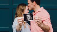Trudnica na ultrazvuku videla tačkice po glavi bebe: Evo šta je to pokazalo, stvarno, rodila se lepotica