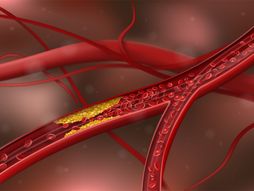 Arterije