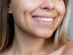 Jamice na obrazima, rupice na obrazima, osmeh