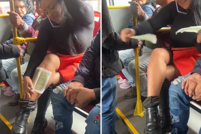 Prevoz depilacija Prevoz depilacija