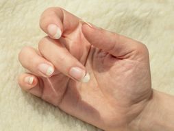 nokti, polomljeni nokat, ruke, prsti, ženski nokti