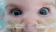 Bebi Indi produženi sati života: Još nije skinuta sa aparata, danas odluka o prekidu lečenja?