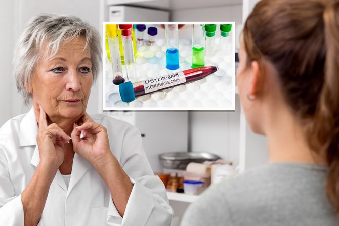 Mononukleoza Mononukleoza