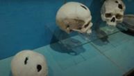 Žena iz bakarnog doba preživela dve operacije lobanje pre 4.500 godina