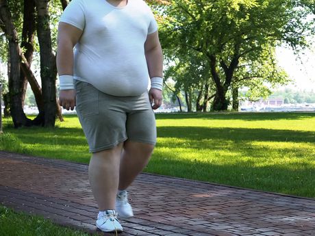 Gojaznost, gojazan čovek šeta